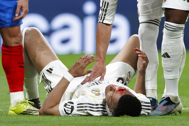 姆巴佩面部缝针伤情曝光 欧冠次回合迎战拜仁